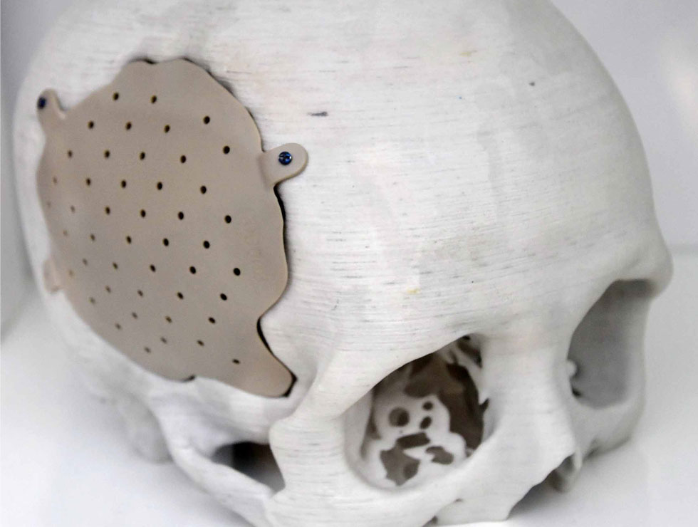 �@������ɫ�ĸ�ˎ��������Ŀ��������3D��ӡ���XĤ��